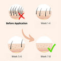 Original IPL Laser Hair Removal Device Kit – Safe, Painless & Effective for All Skin Types