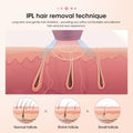 Original IPL Laser Hair Removal Device Kit – Safe, Painless & Effective for All Skin Types