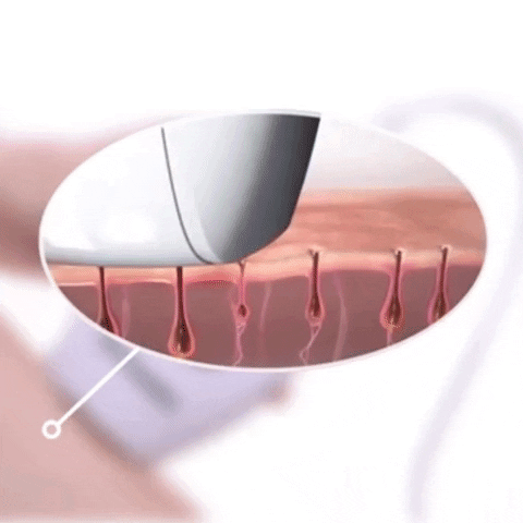 Original IPL Laser Hair Removal Device Kit – Safe, Painless & Effective for All Skin Types